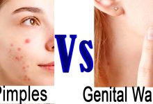 Difference Between Genital Warts And Pimples