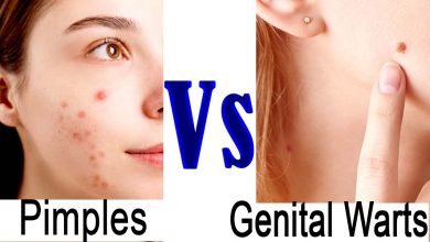 Difference Between Genital Warts And Pimples